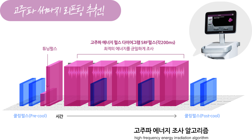 고주파 써마지 리프팅 추천