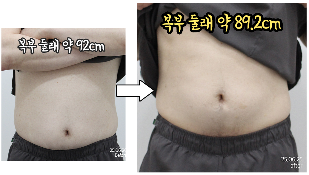 온다 리프딩 전후 이미지